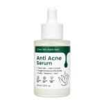 Glowvita Anti Acne Serum (30 ml / 1.01 fl. oz.) – Target Breakouts & Excess Oil with Niacinamide, Zinc PCA, Tea Tree & Aloe Vera | Paraben-Free, Sulfate-Free & Cruelty-Free Serum for Clear, Balanced Skin